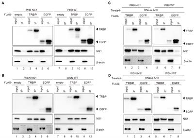 The Interaction of Influenza A NS1 and Cellular TRBP Protein Modulates the Function of RNA Interference Machinery